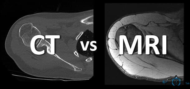 What is the difference between CT scan and MRI?