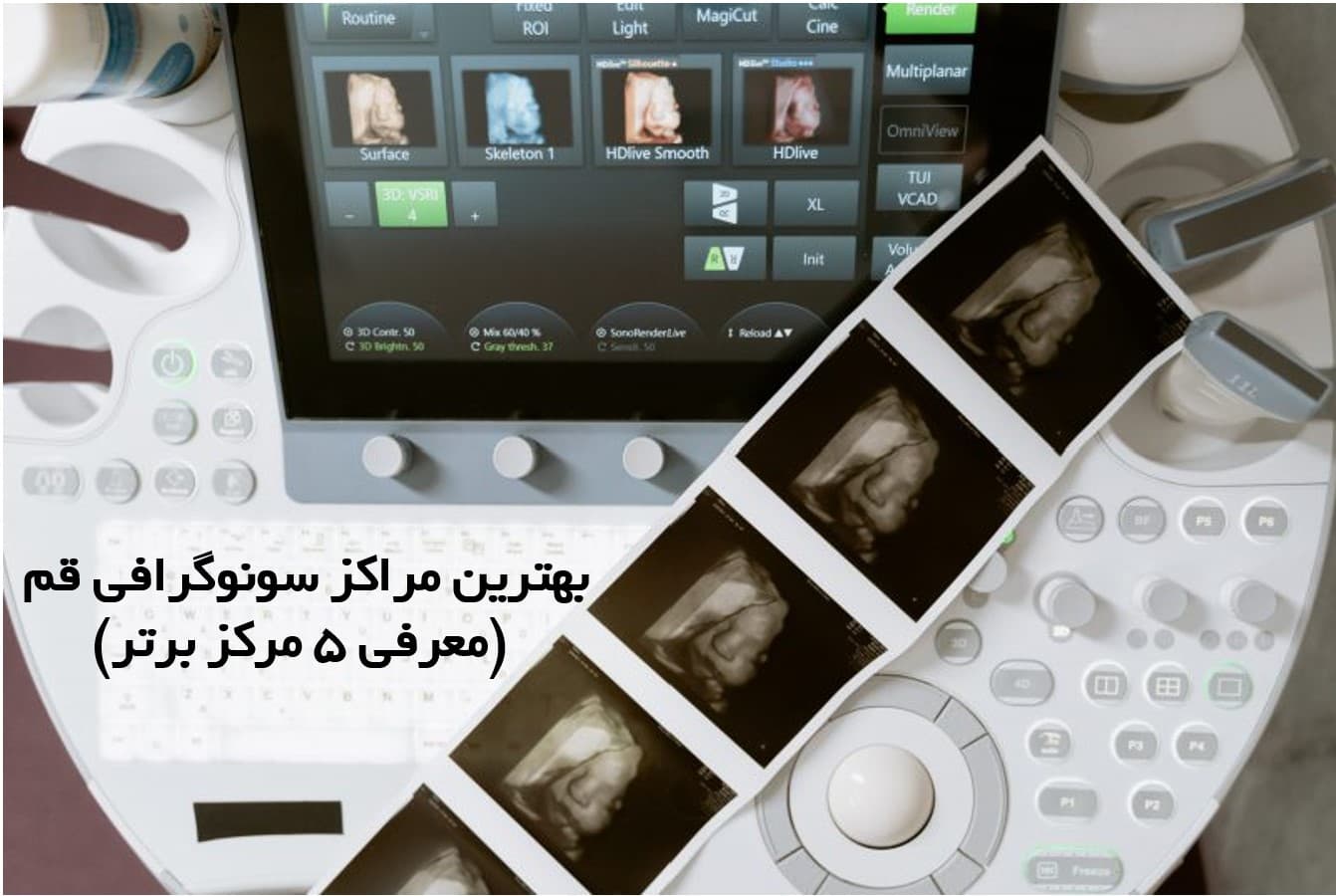 Best Ultrasound Centers in Qom (Top 5 Centers)