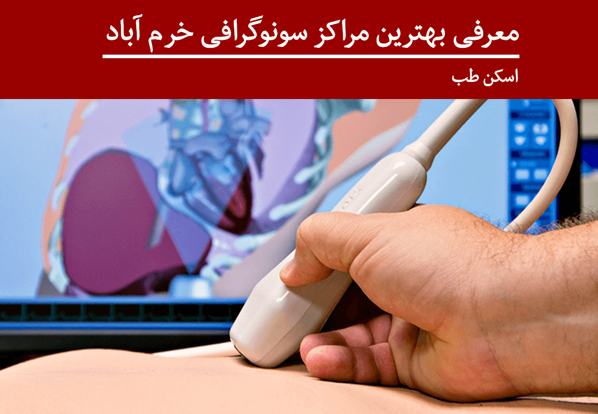 سونوگرافی در خرم اباد (معرفی 5 مرکز برتر سونوگرافی در خرم آباد)