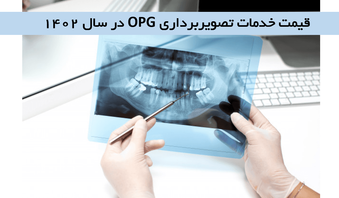 معرفی تصویربرداری OPG و قیمت OPG در سال 1402