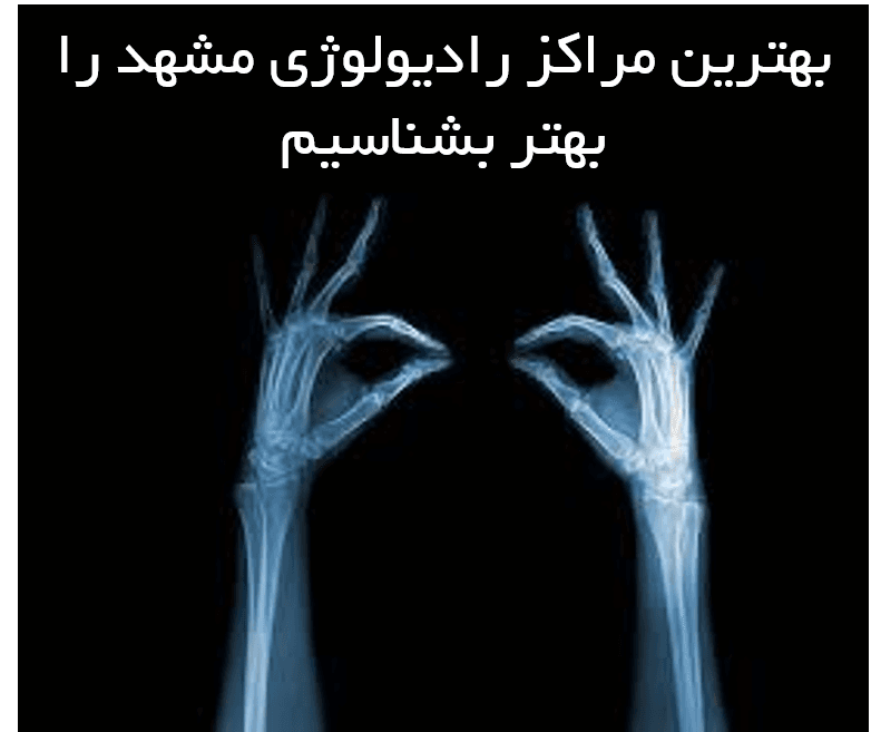 معرفی 10 مرکز برتر رادیولوژی مشهد + سریعترین نوبت رادیولوژی در مشهد