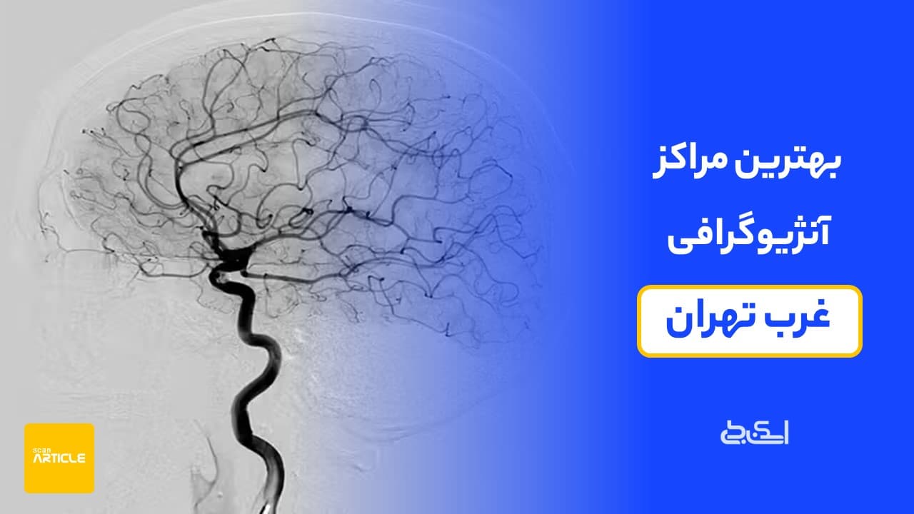 بهترین مرکز آنژیوگرافی غرب تهران (7 مرکز برتر)+ دریافت نوبت