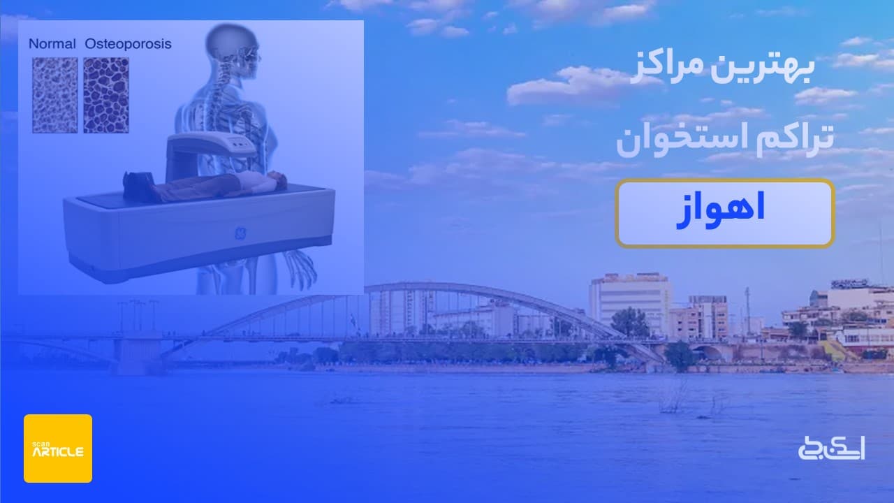 بهترین مرکز سنجش تراکم استخوان اهواز(7مرکز)+نوبت