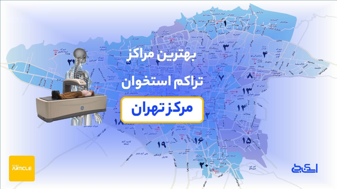 بهترین مراکز تراکم استخوان مرکز تهران(5مرکز)+نوبت