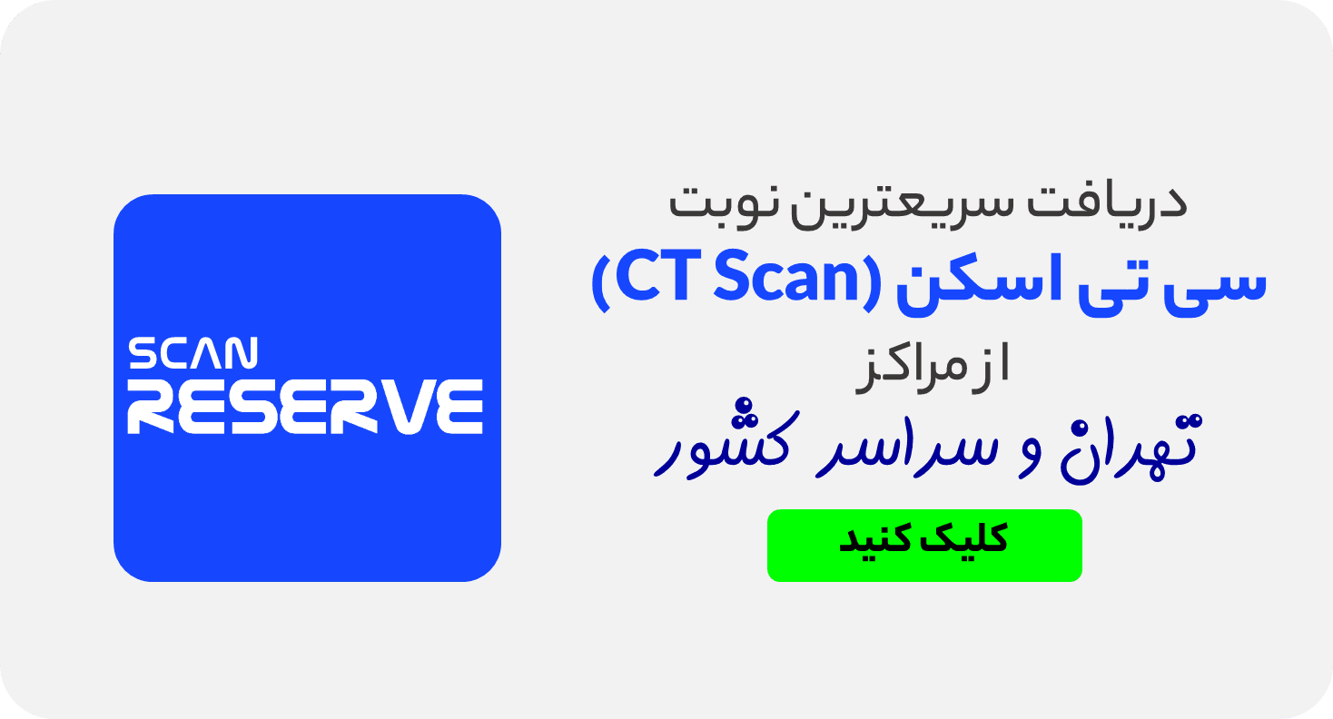 سریعترین نوبت سی تی اسکن در تهران+ 6مرکزبرتر