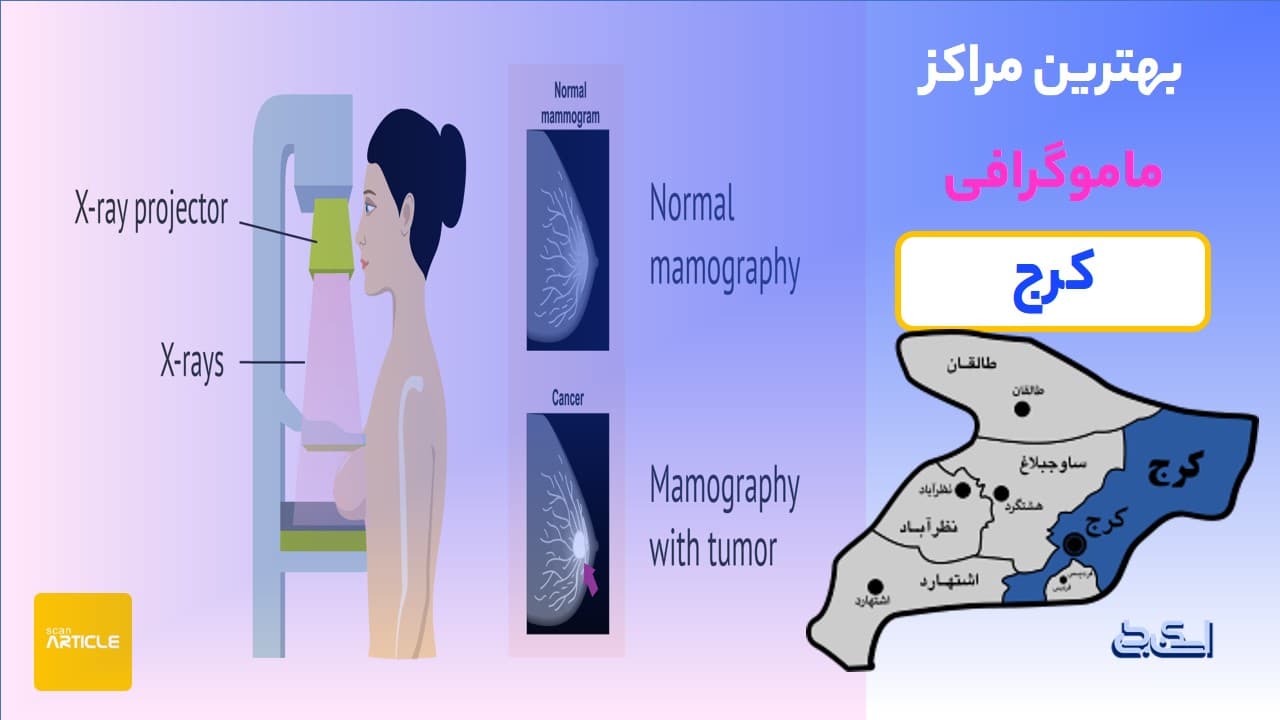 برخی از بهترین مراکز ماموگرافی کرج (7مرکز) + نوبت