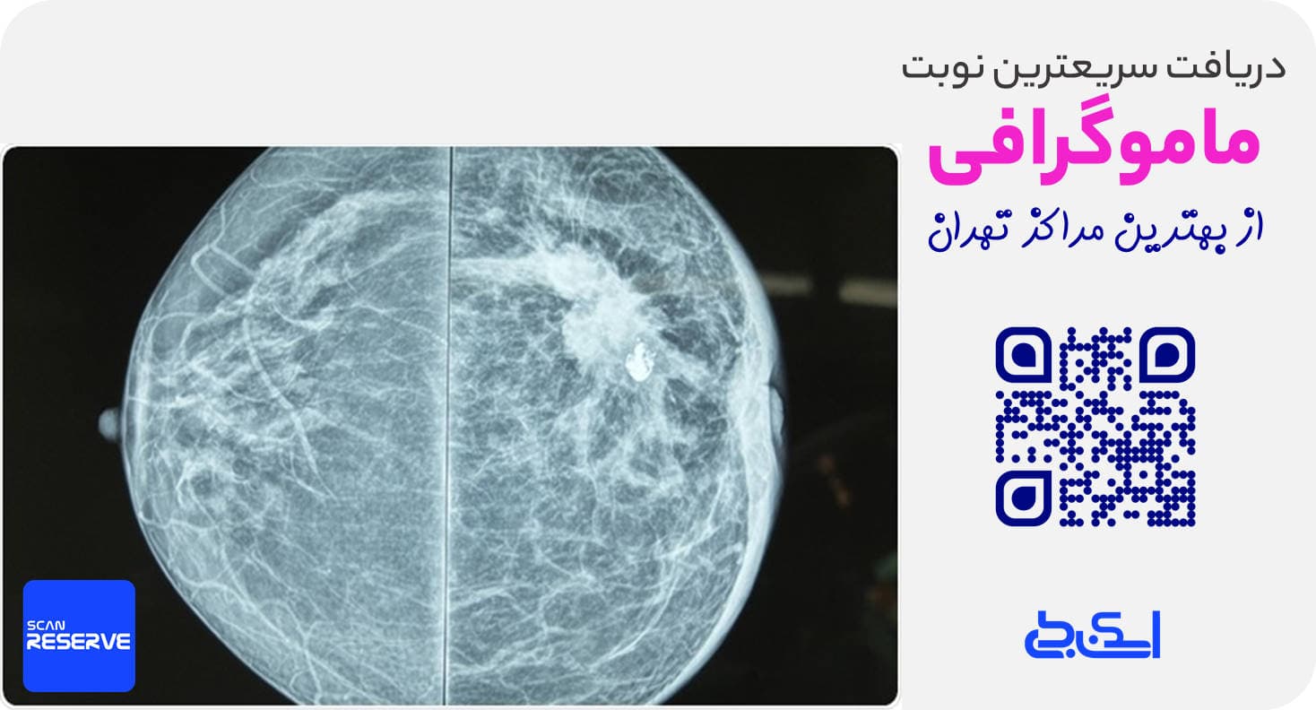 بهترین مراکز ماموگرافی مرکز تهران(7 مرکز)+نوبت