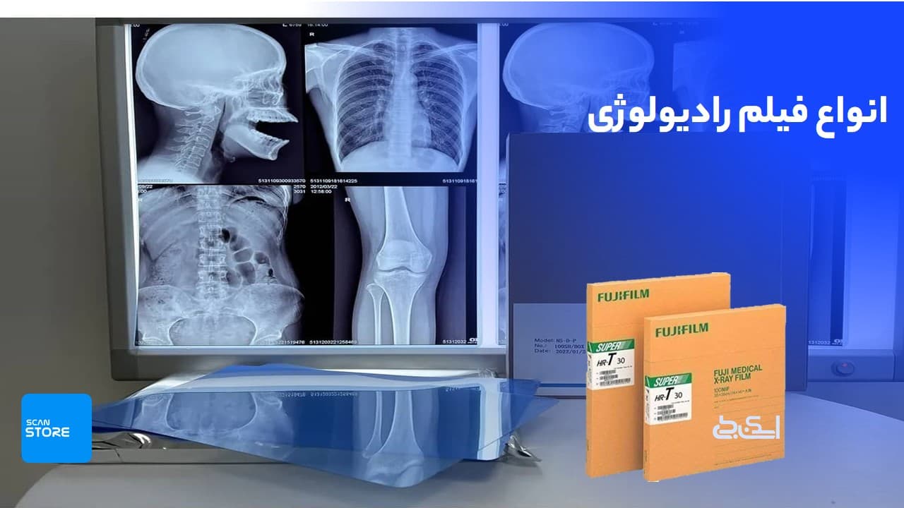 فیلم رادیولوژی، مزایا و معایب و معرفی 4 برند برتر