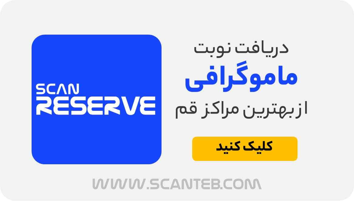 نوبت ماموگرافی قم