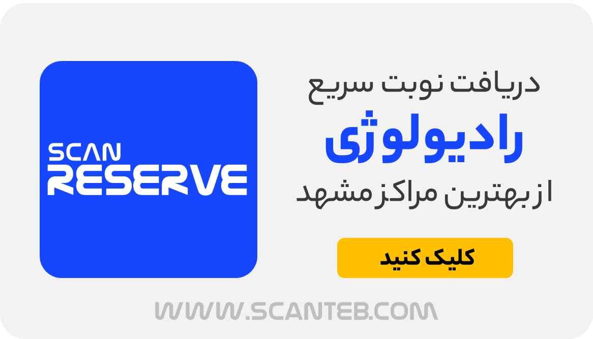 نوبت رادیولوژی مشهد
