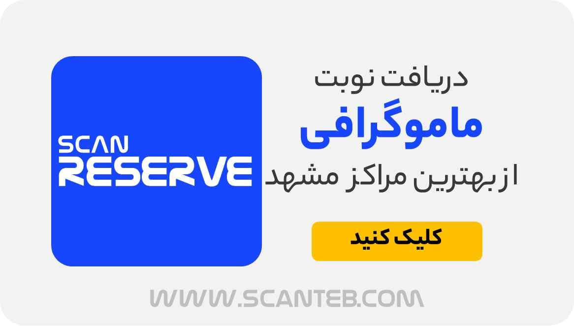 نوبت ماموگرافی مشهد