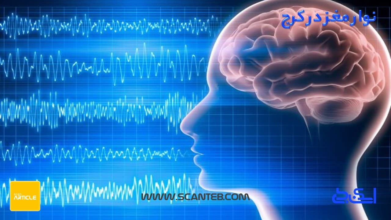 نوار مغز در کرج