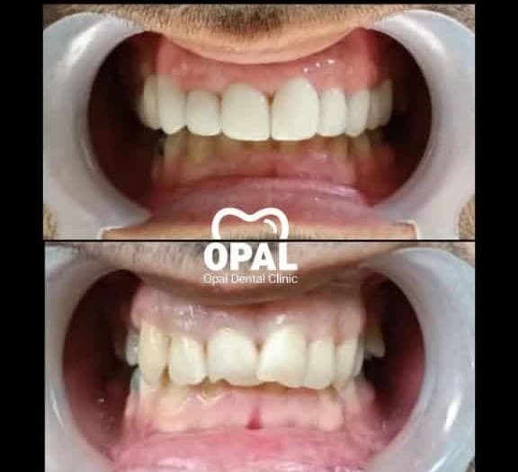 کلینیک دندانپزشکی شبانه روزی اپال سنندج