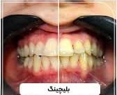 تصویر بخش تصویربرداری