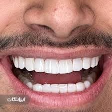 تصویر بخش تصویربرداری