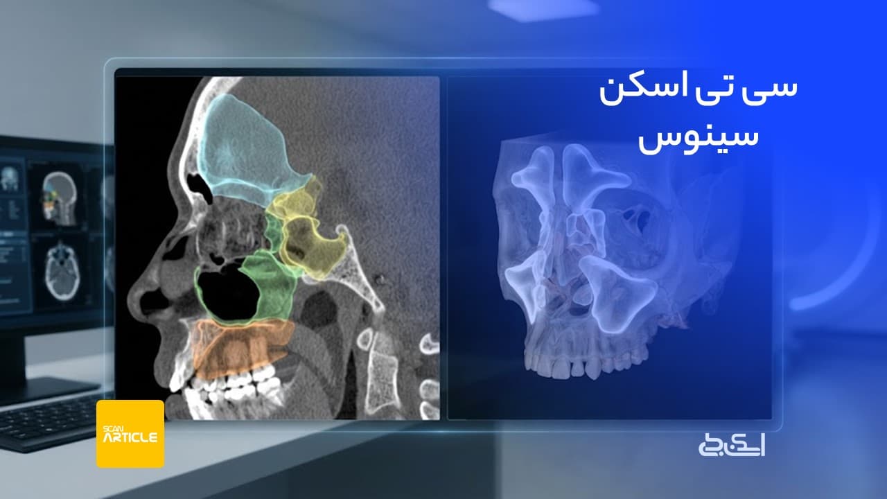 سی تی اسکن سینوس
