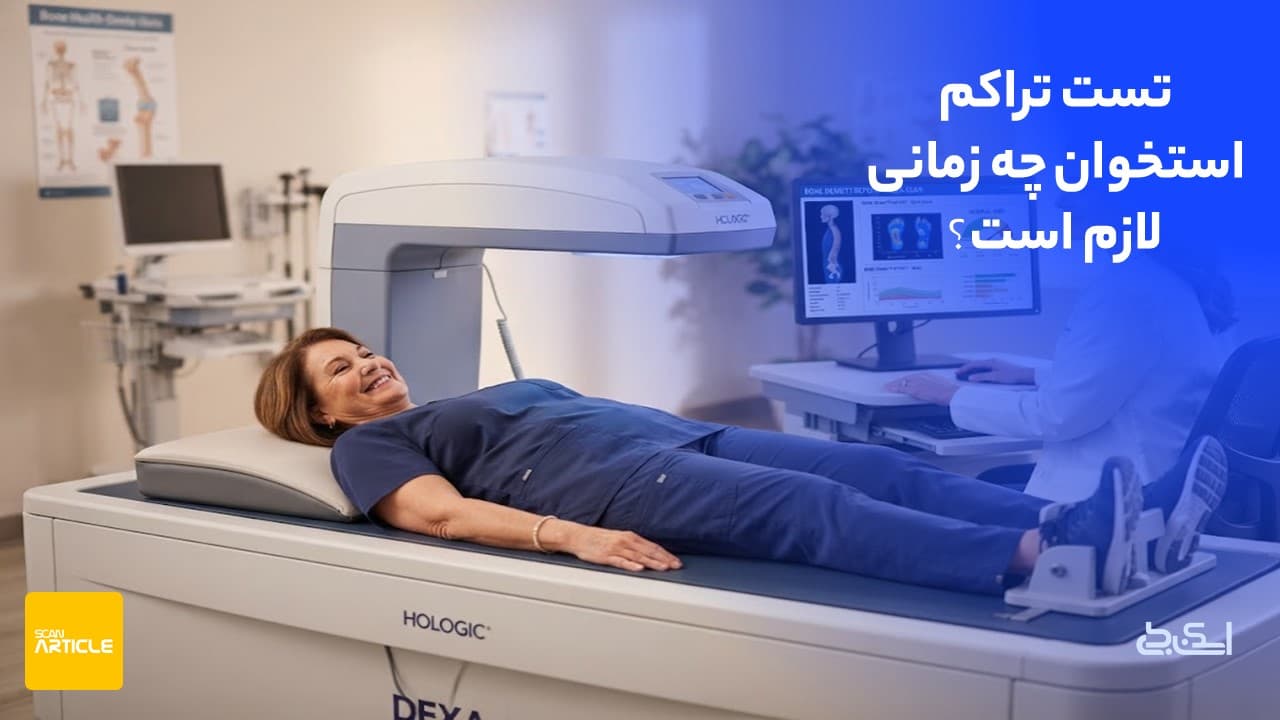 تست تراکم استخوان چه زمانی لازم است؟
