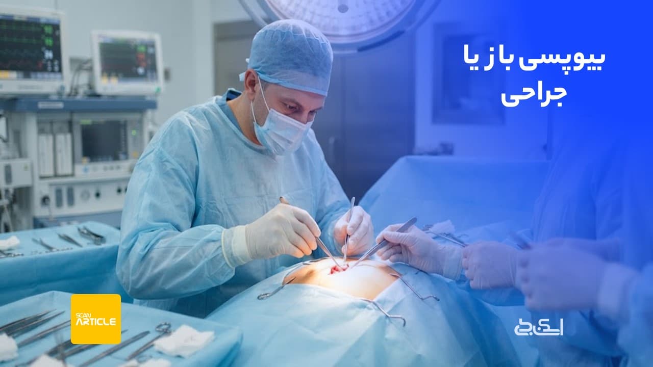 بیوپسی باز یا جراحی