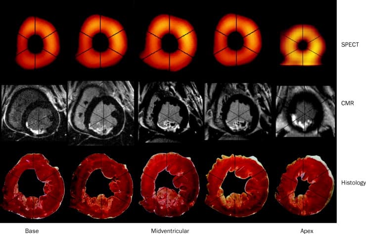 What is the difference between cardiac scan and MRI and heart scan by nuclear medicine?