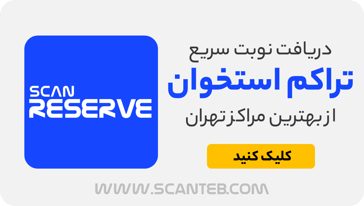 نوبت تراکم استخوان تهران