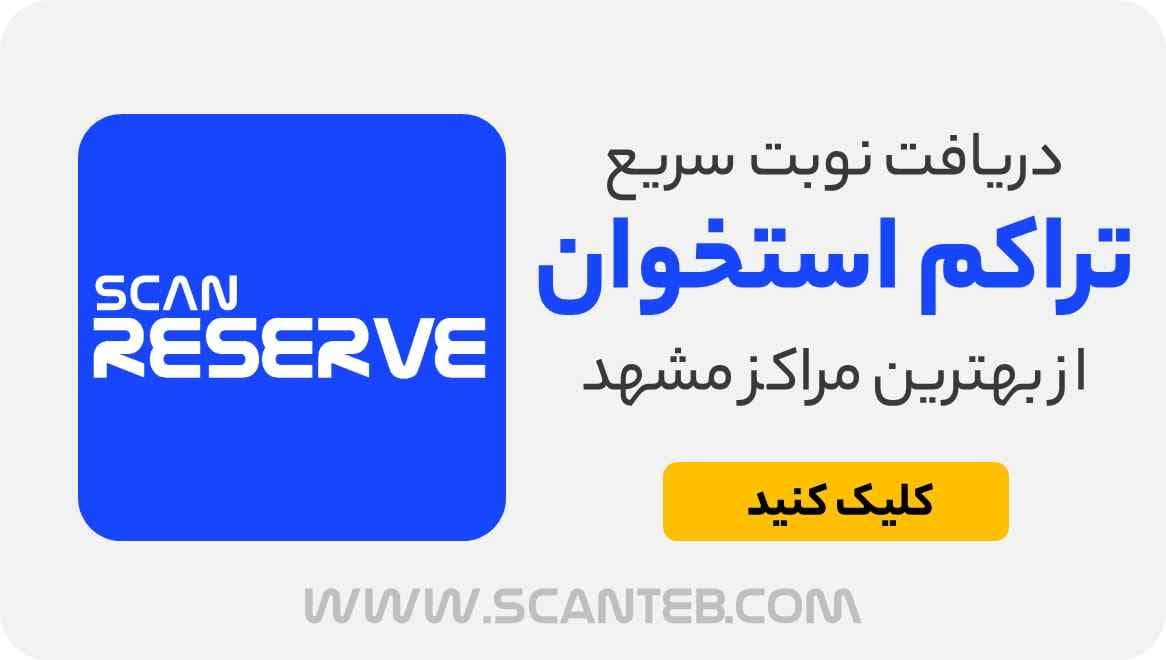 نوبت تراکم استخوان مشهد