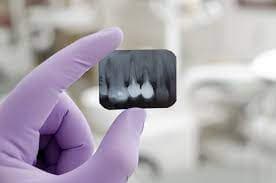 رادیولوژی دهان فک و صورت دکتر مهدیه یاوری پور بیرجند