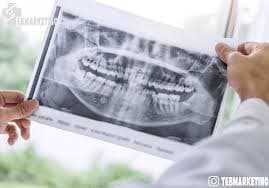 رادیولوژی دهان، فک و صورت دکتر صنم میربیگی یزد