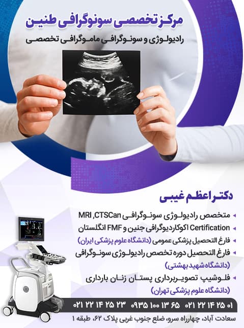 رادیولوژی سونوگرافی تخصصی طنین دکترغیبی تهران