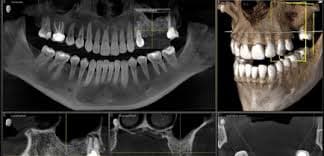 رادیولوژی تخصصی دهان ، فک و صورت راد خرم آباد
