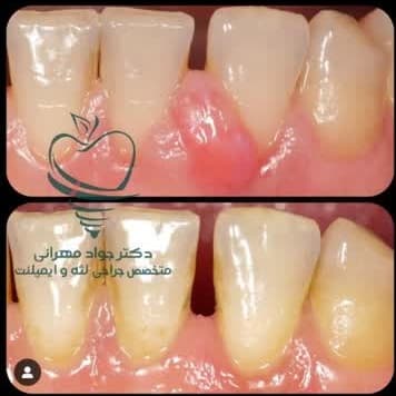 مرکز دندانپزشکی دکتر جواد مهرانی ثابت ساری