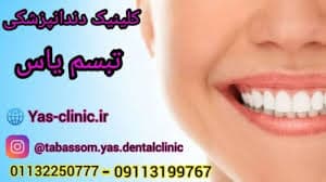 کلینیک دندانپزشکی تبسم یاس بابل مازندران