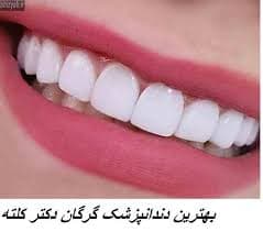 مرکز دندانپزشکی دکتر محمد احمدی کلته گرگان