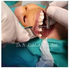 کلینیک دندانپزشکی دکتر نصرت اله رخش خورشید زاهدان