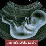 تصویر بخش تصویربرداری