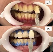 تصویر بخش تصویربرداری