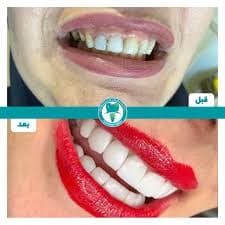 تصویر بخش تصویربرداری