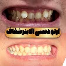 تصویر بخش تصویربرداری
