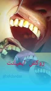 تصویر بخش تصویربرداری