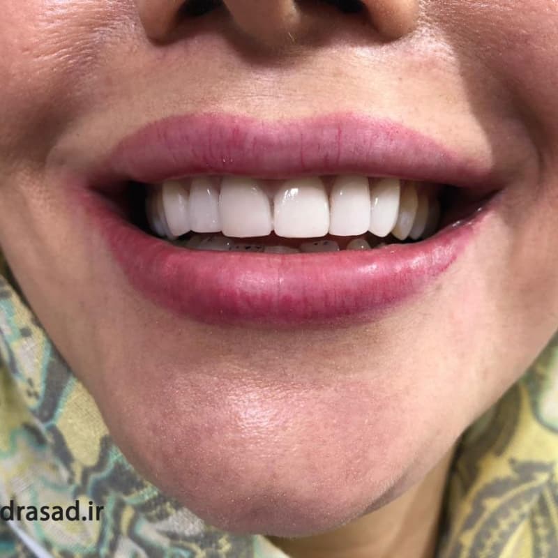 تصویر بخش تصویربرداری
