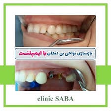 تصویر بخش تصویربرداری