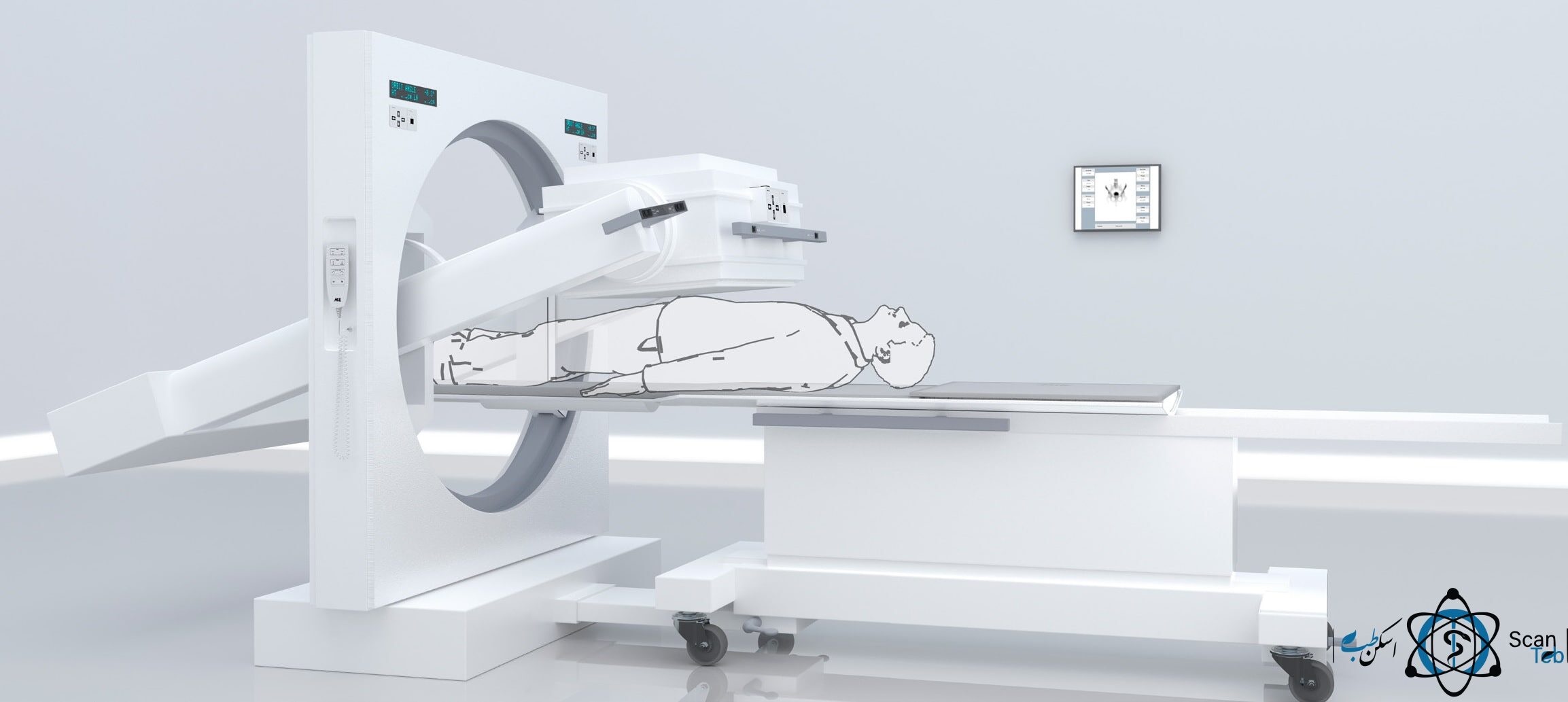 Siemens Mie Diacam Scintron Single Head اسکن طب