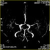 MRI Permanent XGY 0.4 Tesla Scan