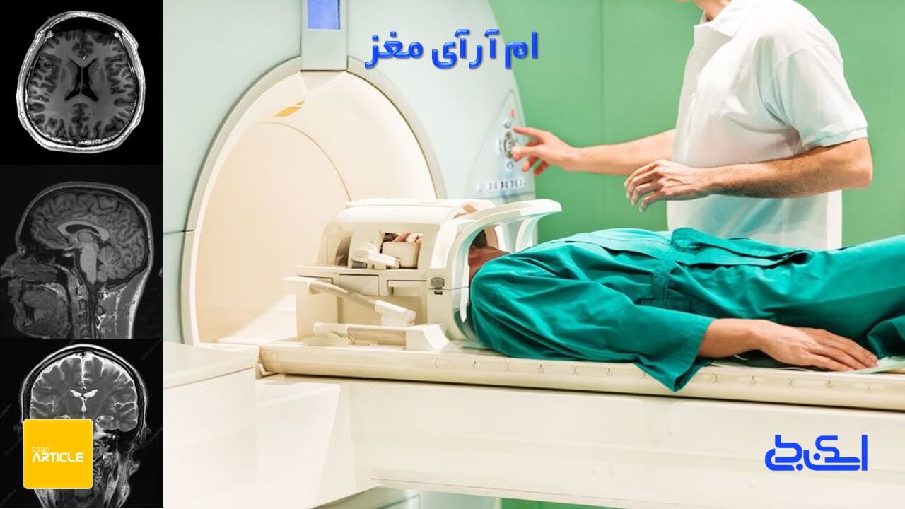 ام آر آی سر