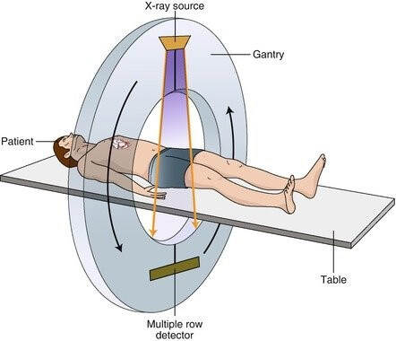 کاربرد تیوب اشعه ایکس در سی تی اسکن