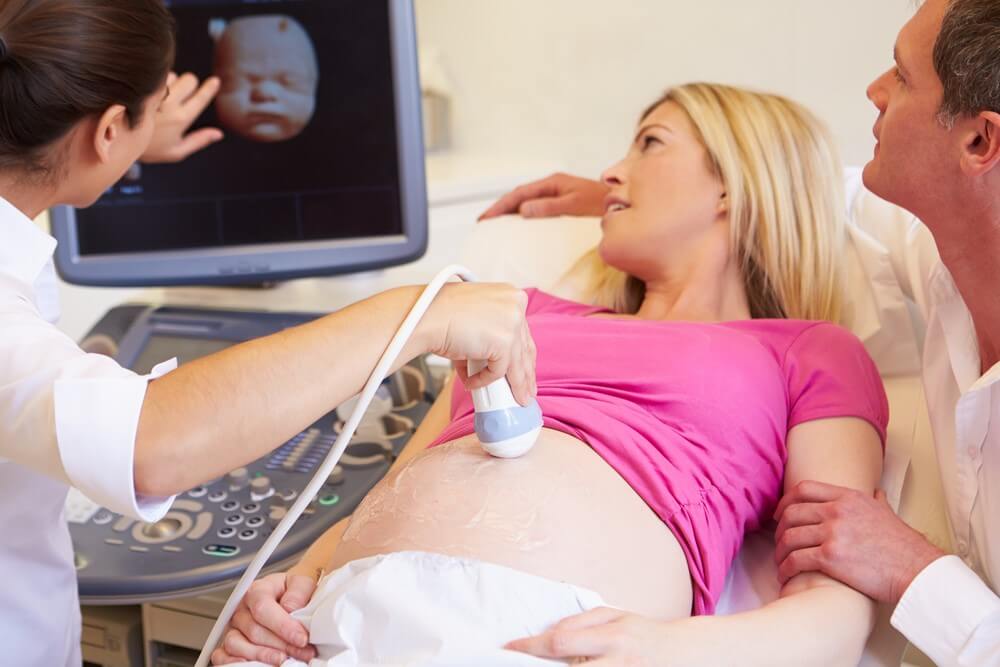What is 4D ultrasound and what is its application?