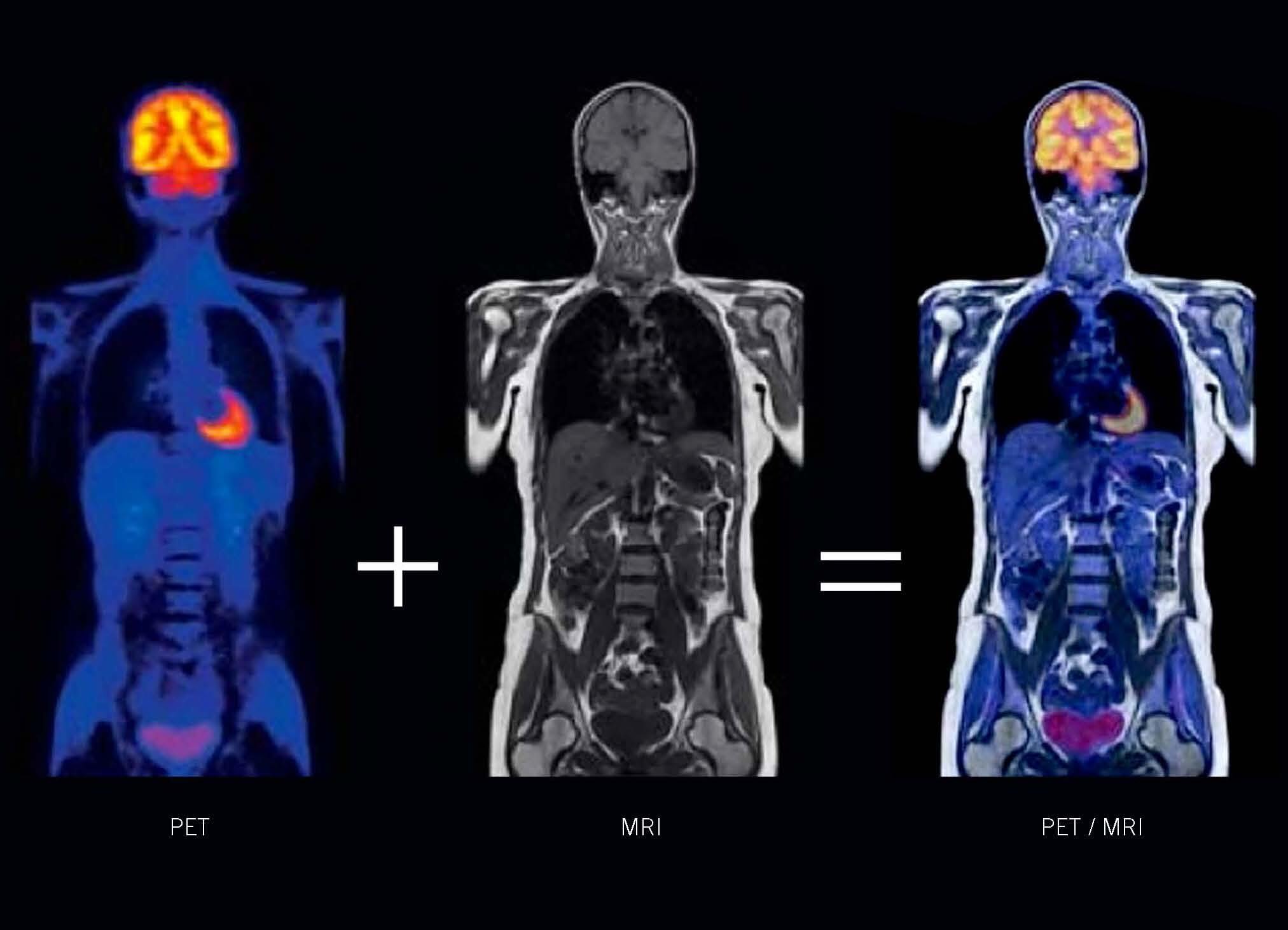 روشهای مختلف تصویربرداری پزشکی پت ام ار ای PET MRI