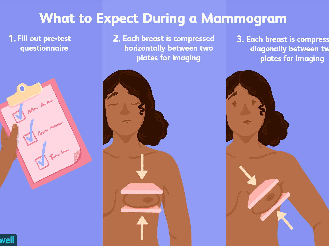 کاربرد ماموگرافی در تشخیص سرطان پستان