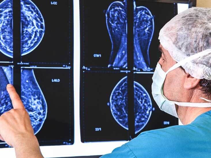 کاربرد ماموگرافی در تشخیص سرطان پستان