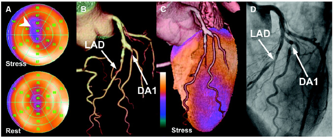 What is the difference between cardiac scan and MRI and heart scan by nuclear medicine?