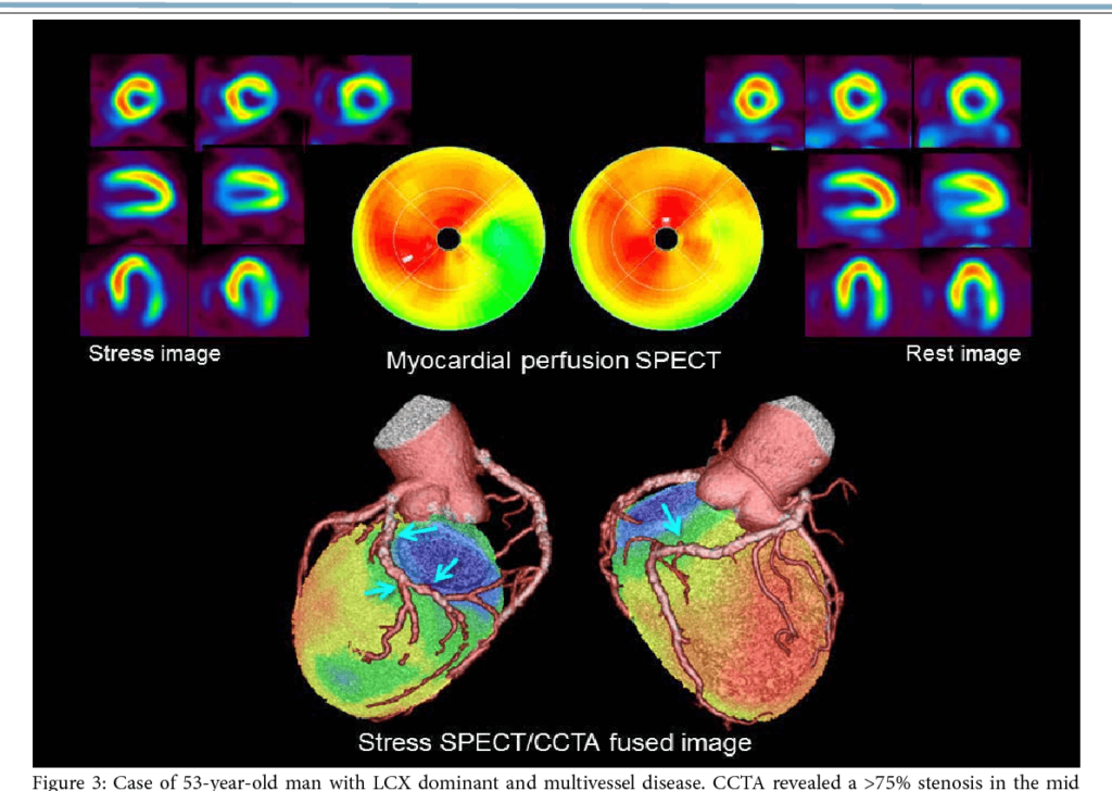 تفاوت اسکن قلب با ام‌آر‌آی و اسکن قلب به روش پزشکی هسته‌ای چیست؟